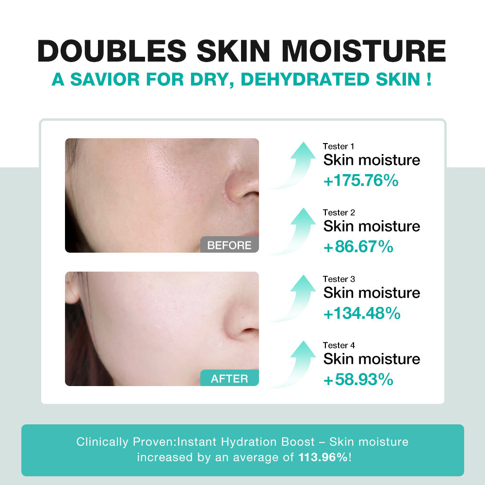 SKINEVER Centella Soothing Cream – Calming & Moisturizing Cica Cream for Sensitive Skin | UAE
