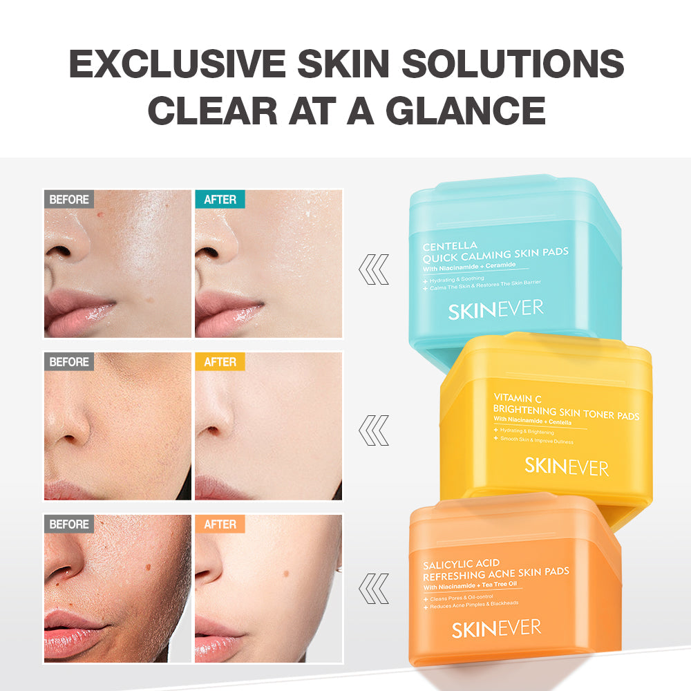 SKINEVER Centella Quick Relief Hydrating Toner Pads – Soothing & Moisturizing Cica Toner Pads for Sensitive Skin | UAE
