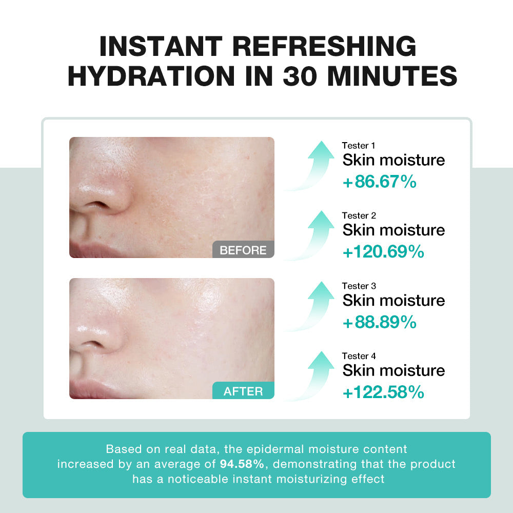 SKINEVER Centella Skin Soothing Toner – Calming, Hydrating & Redness-Reducing Formula | UAE